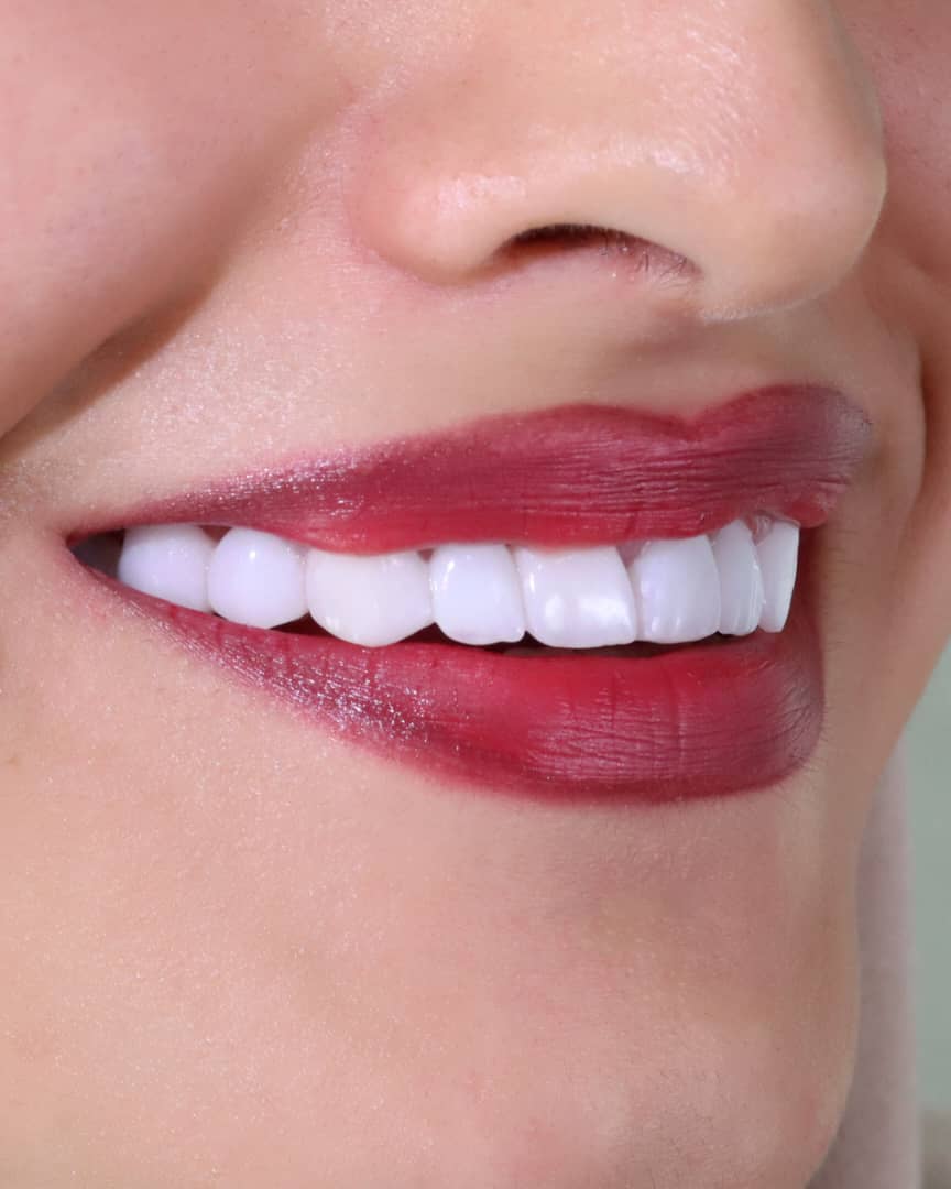 مطب دندانپزشکی دکتر محدثه نصیری در قوچان